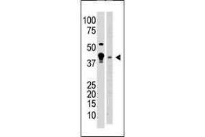 Image no. 1 for anti-Methyl-CpG Binding Domain Protein 2 (MBD2) (AA 120-151), (AA 120-152) antibody (ABIN387915)