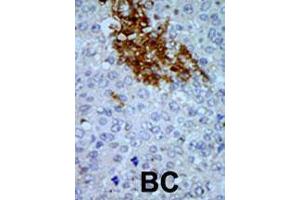 Image no. 1 for anti-Pregnancy Up-Regulated Non-Ubiquitously Expressed CaM Kinase (PNCK) (AA 314-343), (C-Term) antibody (ABIN391139)