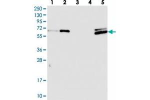 Image no. 2 for anti-CTD (Carboxy-Terminal Domain, RNA Polymerase II, Polypeptide A) Small Phosphatase Like 2 (CTDSPL2) antibody (ABIN5576136)