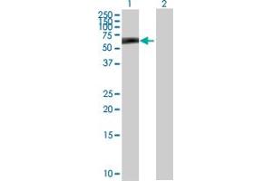 Image no. 1 for anti-Homeobox Containing 1 (HMBOX1) (AA 1-420) antibody (ABIN528967)