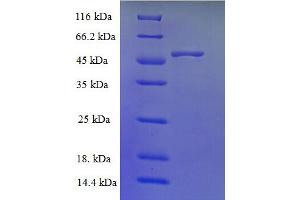 TMLHE Protein (AA 16-376) (His tag)