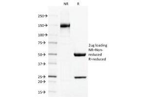 Image no. 3 for anti-Thrombomodulin (THBD) (AA 69-194) antibody (ABIN4949900)