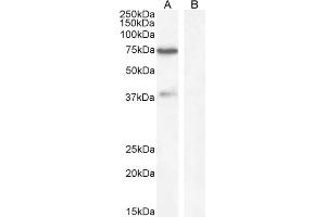 Image no. 1 for anti-Zinc Finger Protein 803 (ZNF803) (Internal Region) antibody (ABIN570947)
