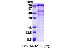 Human Alveolar Soft Part Sarcoma Chromosome Region Candidate 1 Aspscr1 Protein His Recombinant Abin