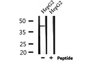 Image no. 5 for anti-Parkinson Protein 7 (PARK7) (C-Term) antibody (ABIN6264038)