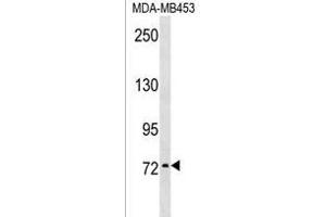 KAL1 Antibody (N-term) (ABIN1539108 and ABIN2838189) western blot analysis in MDA-M cell line lysates (35 μg/lane).