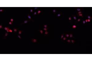Image no. 2 for anti-Tumor Protein P63 (TP63) (C-Term) antibody (ABIN6263986)