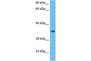 Image no. 3 for anti-Paired-Like Homeodomain 1 (PITX1) (N-Term) antibody (ABIN2779576)