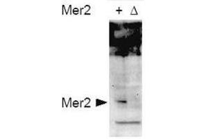Image no. 1 for anti-CD151 (CD151) (AA 26-35), (pSer30) antibody (ABIN129680)
