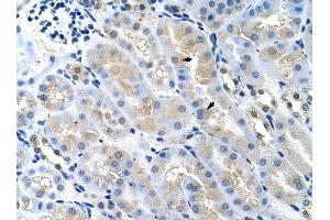 Image no. 1 for anti-Tumor Susceptibility Gene 101 (TSG101) (Middle Region) antibody (ABIN925845)