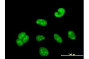 Image no. 2 for anti-Williams Beuren Syndrome Chromosome Region 22 (WBSCR22) (AA 1-281) antibody (ABIN530240)