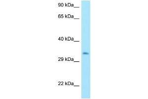 WB Suggested Anti-MTX3 Antibody Titration: 1.