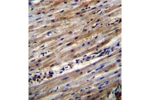 Image no. 1 for anti-Dihydrouridine Synthase 1-Like (DUS1L) (AA 320-349), (C-Term) antibody (ABIN951996)