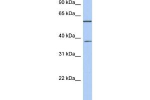 Image no. 1 for anti-Nucleoporin 43kDa (NUP43) (Middle Region) antibody (ABIN2786439)