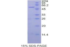 Image no. 1 for Sialic Acid Acetylesterase (SIAE) (AA 22-244) protein (His tag,GST tag) (ABIN1877273)