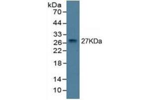 Mouse Detection antibody from the kit in WB with Positive Control: Sample Eukaryotic TNFa protein.