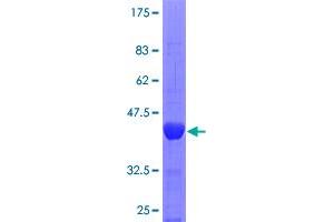 Image no. 1 for Sperm Associated Antigen 5 (SPAG5) (AA 1082-1191) protein (GST tag) (ABIN1321059)