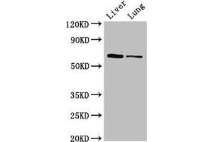 Western Blot Positive WB detected in: Mouse liver tissue, Rat lung tissue All lanes: Ces1c antibody at 5 μg/mL Secondary Goat polyclonal to rabbit IgG at 1/50000 dilution Predicted band size: 62 kDa Observed band size: 62 kDa