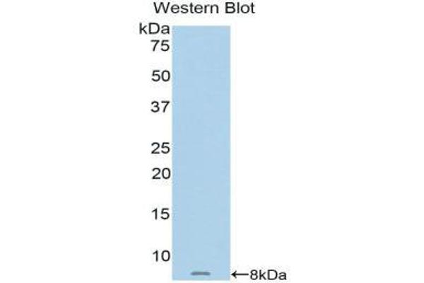 anti-Metallothionein 2 (MT2) (AA 1-62) antibody