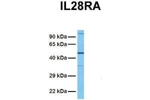 Image no. 2 for anti-Interleukin 28 Receptor, alpha (Interferon, lambda Receptor) (IL28RA) (N-Term) antibody (ABIN2783214)
