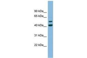 Image no. 1 for anti-Ankyrin Repeat and MYND Domain Containing 2 (ANKMY2) (N-Term) antibody (ABIN6744186)