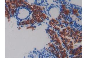 Image no. 2 for anti-Fibulin 5 (FBLN5) (AA 170-243) antibody (ABIN1858821)