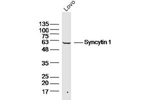 Image no. 3 for anti-Syncytin A (SYNA) (AA 451-538) antibody (ABIN682318)