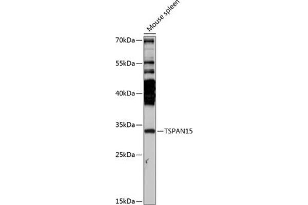 Tetraspanin 15 antibody  (AA 110-220)