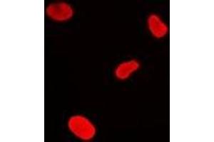 Image no. 1 for anti-H2A Histone Family, Member Y (H2AFY) antibody (ABIN2966788)