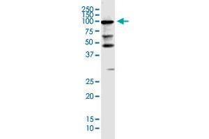 Image no. 3 for anti-KIAA0226 (KIAA0226) (AA 1-375) antibody (ABIN2752283)