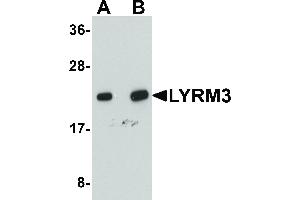 Image no. 1 for anti-NADH Dehydrogenase (Ubiquinone) 1 beta Subcomplex, 9, 22kDa (NDUFB9) (C-Term) antibody (ABIN6657184)
