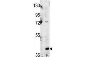 Image no. 4 for anti-Mitogen-Activated Protein Kinase 14 (MAPK14) (AA 295-324) antibody (ABIN3031831)