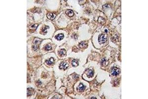 Image no. 1 for anti-Insulin Receptor-Related Receptor (INSRR) (AA 16-47) antibody (ABIN3029806)