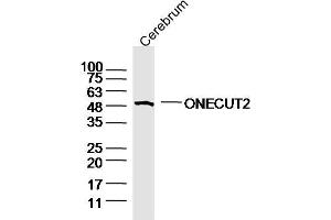 Image no. 1 for anti-One Cut Homeobox 2 (ONECUT2) (AA 401-504) antibody (ABIN5557503)