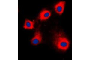 Image no. 2 for anti-Heat Shock 10kDa Protein 1 (Chaperonin 10) (HSPE1) (Center) antibody (ABIN2706346)