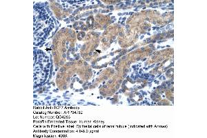 Image no. 1 for anti-Transcription Factor 7 (T-Cell Specific, HMG-Box) (TCF7) (Middle Region) antibody (ABIN2776021)