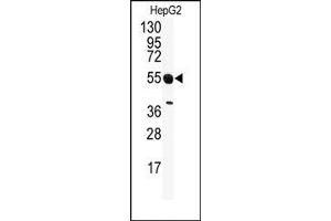 Image no. 1 for anti-serine/threonine Kinase 25 (STK25) (C-Term) antibody (ABIN360359)