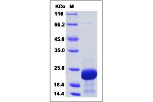 Image no. 1 for Stathmin 1 (STMN1) (AA 1-149) protein (His tag) (ABIN2006516)