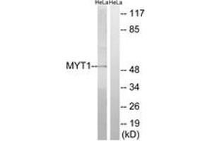 Image no. 1 for anti-Protein Kinase, Membrane Associated tyrosine/threonine 1 (PKMYT1) (AA 49-98) antibody (ABIN2879115)
