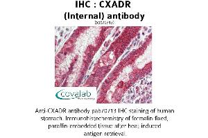 Image no. 2 for anti-Coxsackie Virus and Adenovirus Receptor (CXADR) (Internal Region) antibody (ABIN1733388)