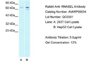 anti-Ribonuclease L (2',5'-Oligoisoadenylate Synthetase-Dependent) (RNASEL) (C-Term) antibody