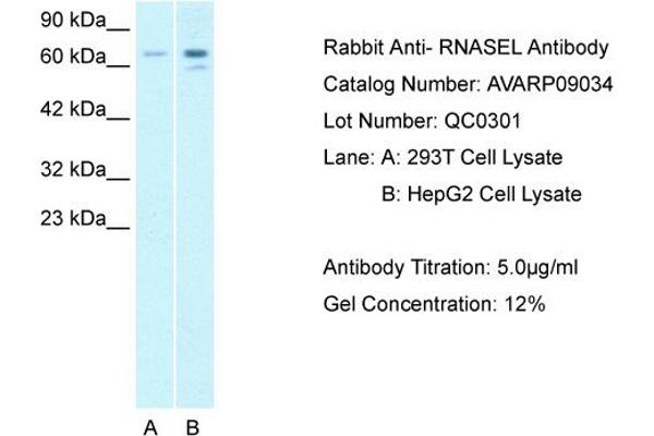 anti-Ribonuclease L (2',5'-Oligoisoadenylate Synthetase-Dependent) (RNASEL) (C-Term) antibody