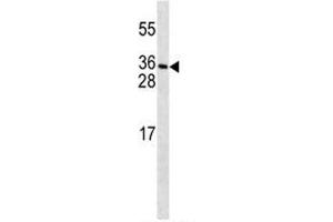 Image no. 3 for anti-Platelet-Derived Growth Factor C (PDGFC) (AA 74-103) antibody (ABIN3032248)