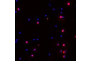 Image no. 4 for anti-Proteinase 3 (PRTN3) (C-Term) antibody (ABIN350763)