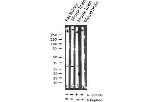 Image no. 1 for anti-Protein Phosphatase 1, Regulatory (Inhibitor) Subunit 1B (PPP1R1B) (pThr34) antibody (ABIN6255670)