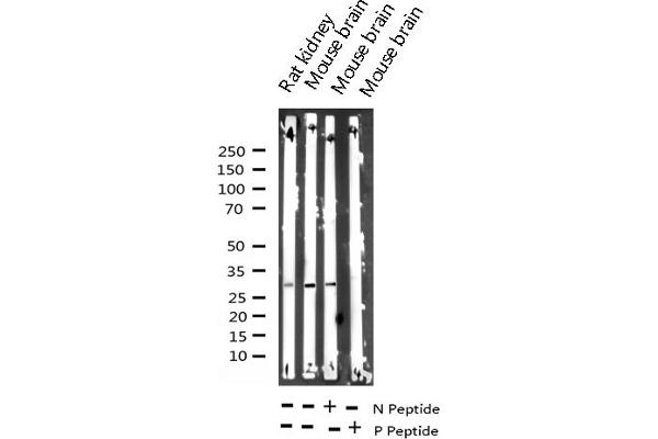 anti-Protein Phosphatase 1, Regulatory (Inhibitor) Subunit 1B (PPP1R1B) (pThr34) antibody