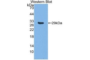 Image no. 1 for anti-TNF Receptor-Associated Factor 1 (TRAF1) (AA 169-392) antibody (ABIN1860858)