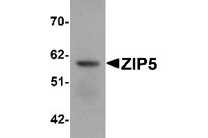 Western Blotting (WB) image for anti-Solute Carrier Family 39 (Metal Ion Transporter), Member 5 (SLC39A5) (Middle Region) antibody (ABIN1031181)