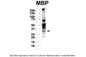 Image no. 2 for anti-Myelin Basic Protein (MBP) (Middle Region) antibody (ABIN2786586)