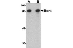 Image no. 2 for anti-Protein Aurora Borealis (BORA) (N-Term) antibody (ABIN499491)